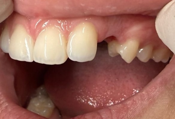 Before - Smile Success