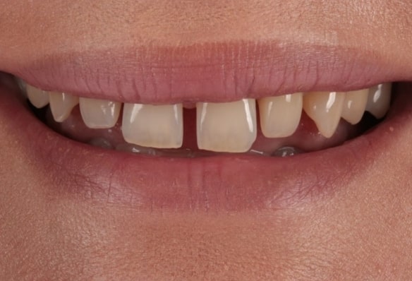 Before - Smile Success
