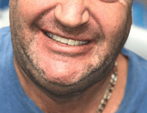 After Smile Success