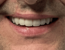 After Smile Success