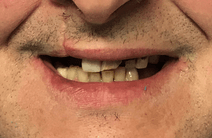 Before Smile Success