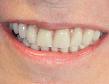 After Smile Success