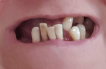 Before Smile Success