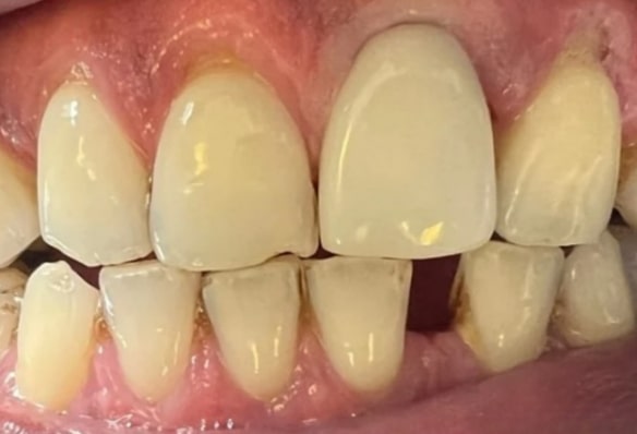 After -Smile Success
