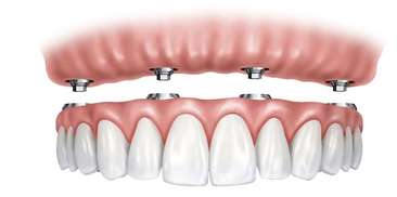 Teeth Image