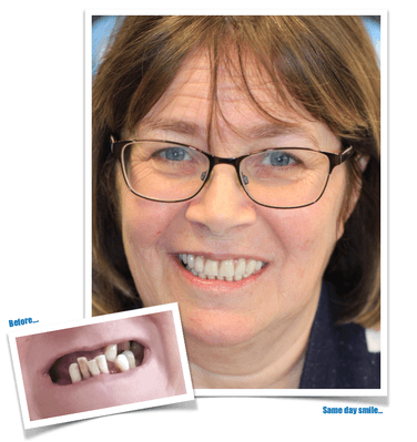 Smile Success Consultation Image