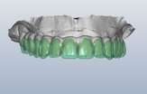 Smile Success Teeth Image