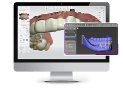 Smile Success Patient Journey