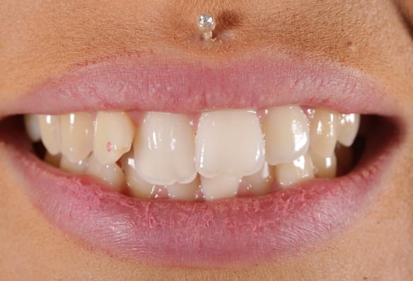Before - Smile Success