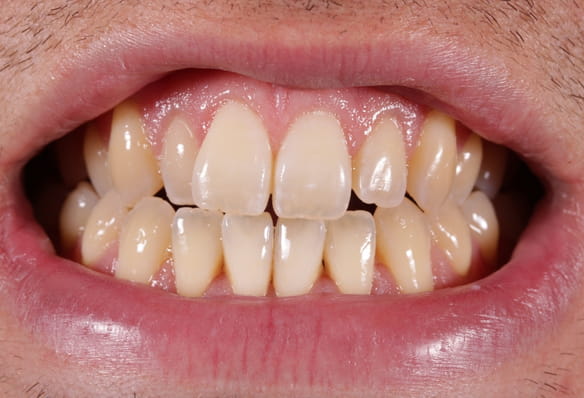 Before - Smile Success