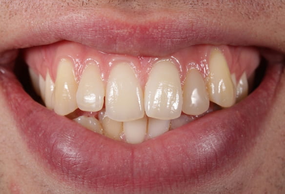 Before - Smile Success