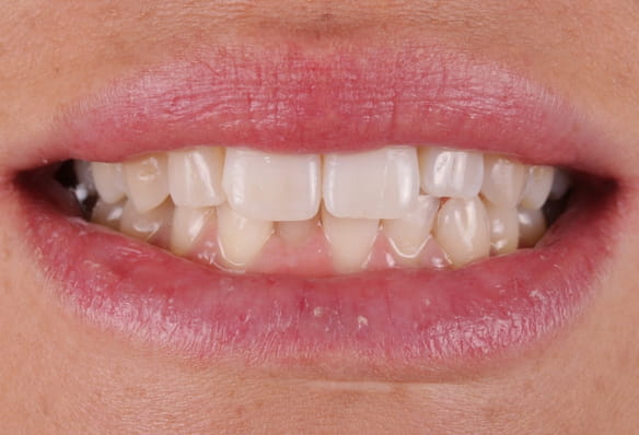 After -Smile Success
