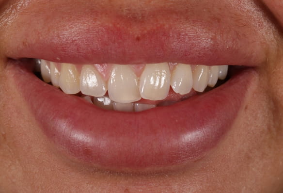 Before - Smile Success