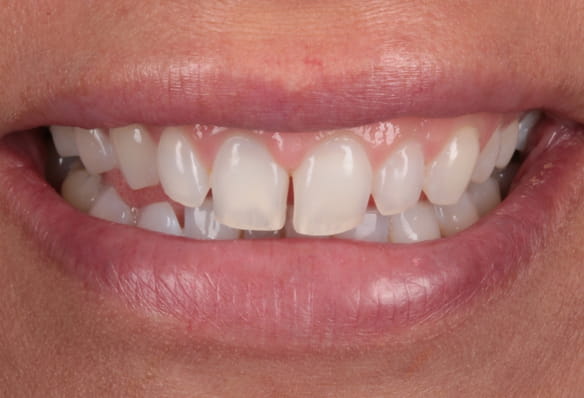 Before - Smile Success