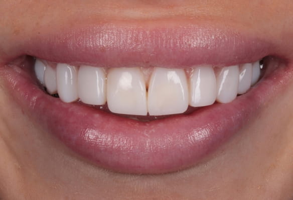 After -Smile Success