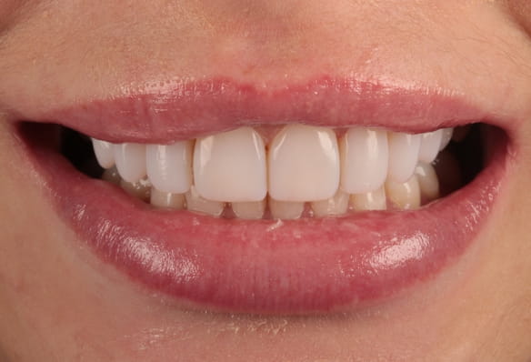 After -Smile Success