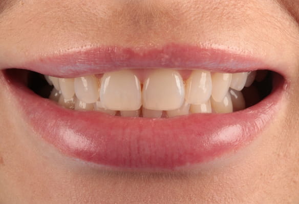Before - Smile Success