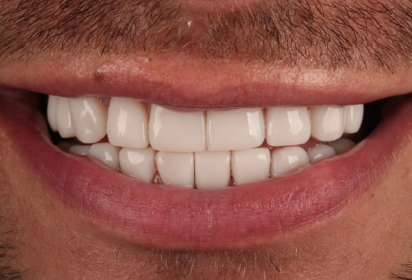 After -Smile Success