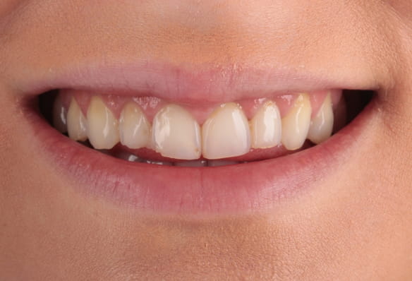 Before - Smile Success