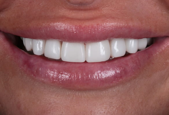 After -Smile Success