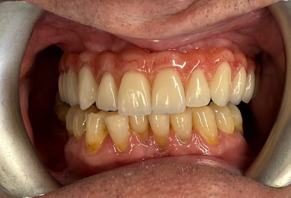 Before - Smile Success