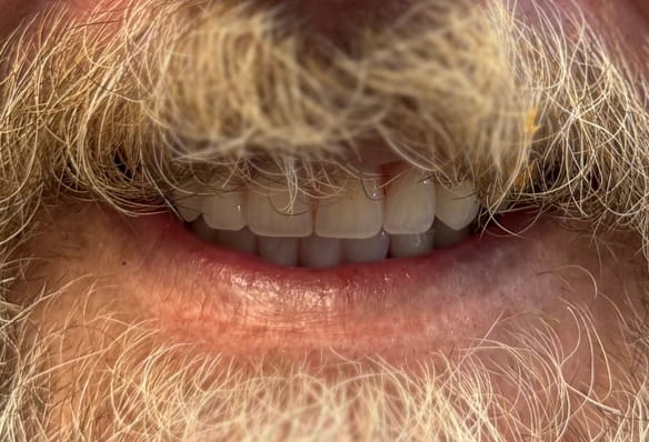 After -Smile Success
