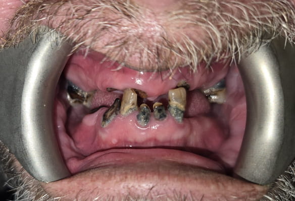 Before - Smile Success