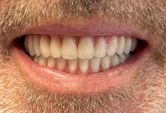 After -Smile Success