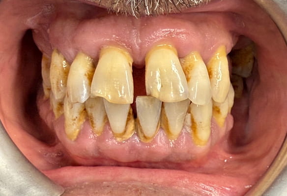 Before - Smile Success