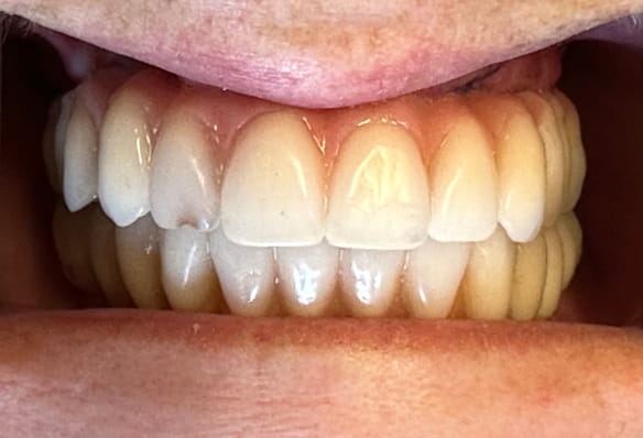 After -Smile Success