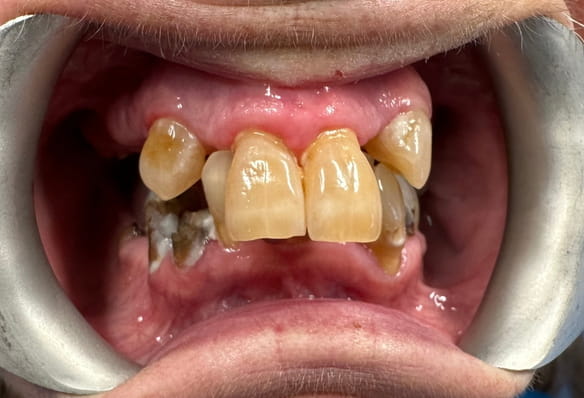 Before - Smile Success
