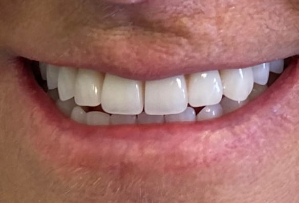 After -Smile Success