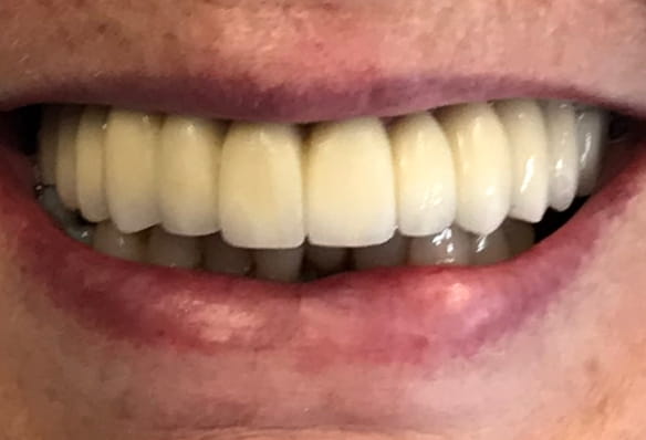After -Smile Success
