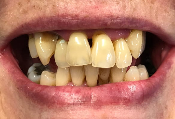Before - Smile Success