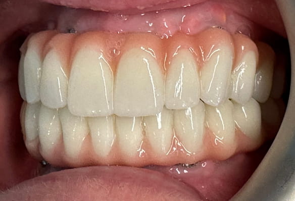 After -Smile Success